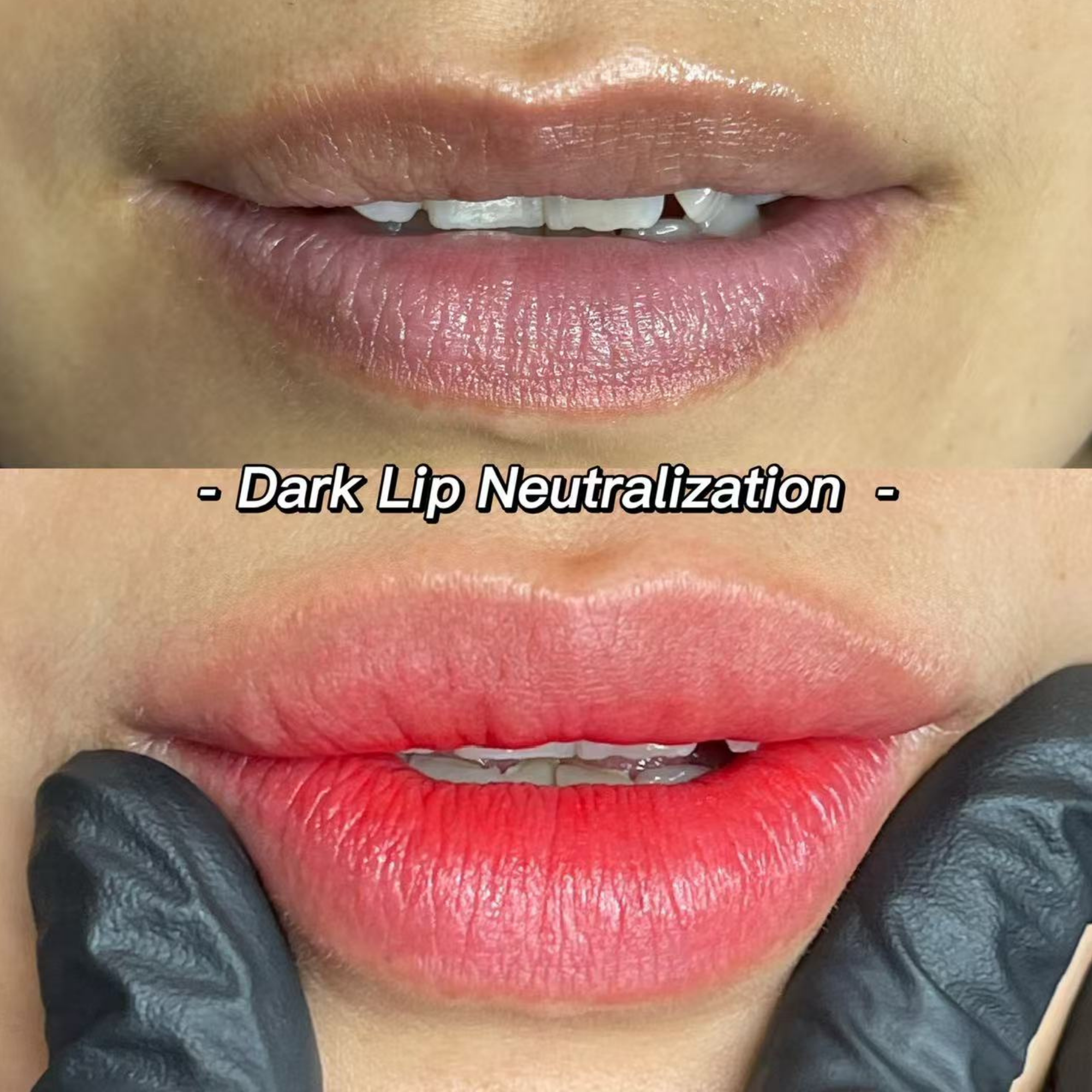 Home page(图23) Dark Lip Nuetralization