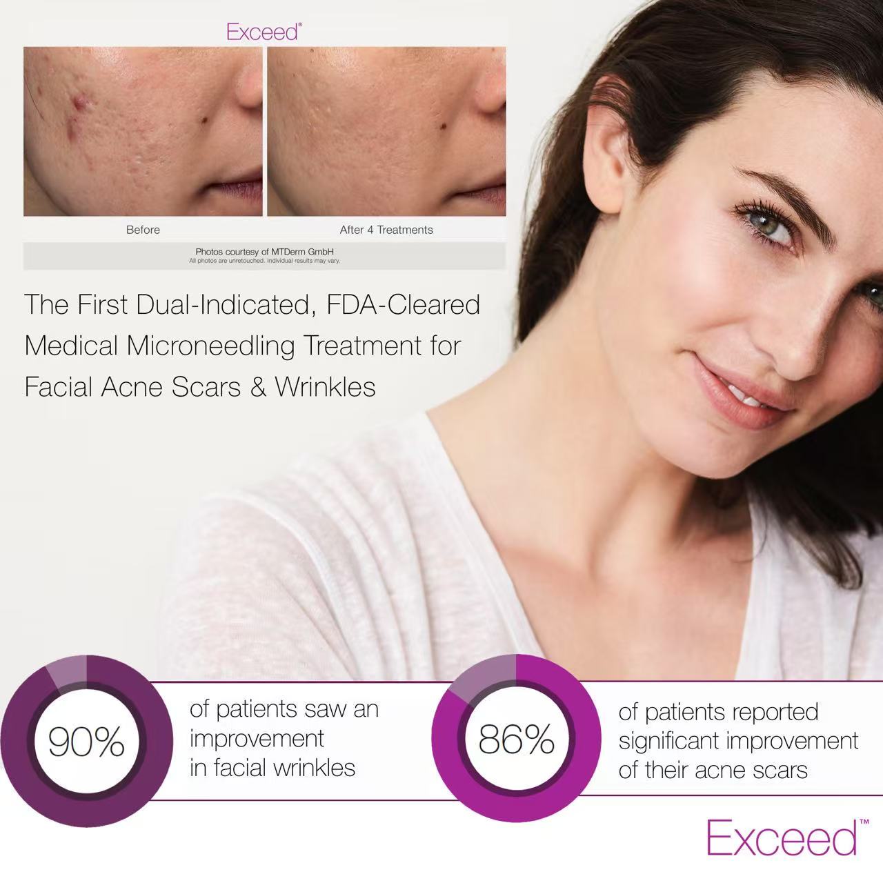 Home page(图27) For Enlarged Pores