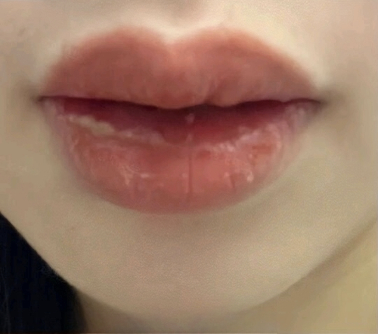 Lip blush(图12) Day 3–4